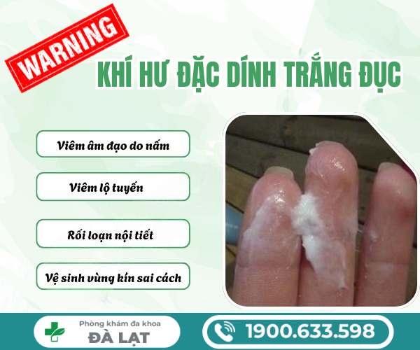 Hình ảnh minh họa